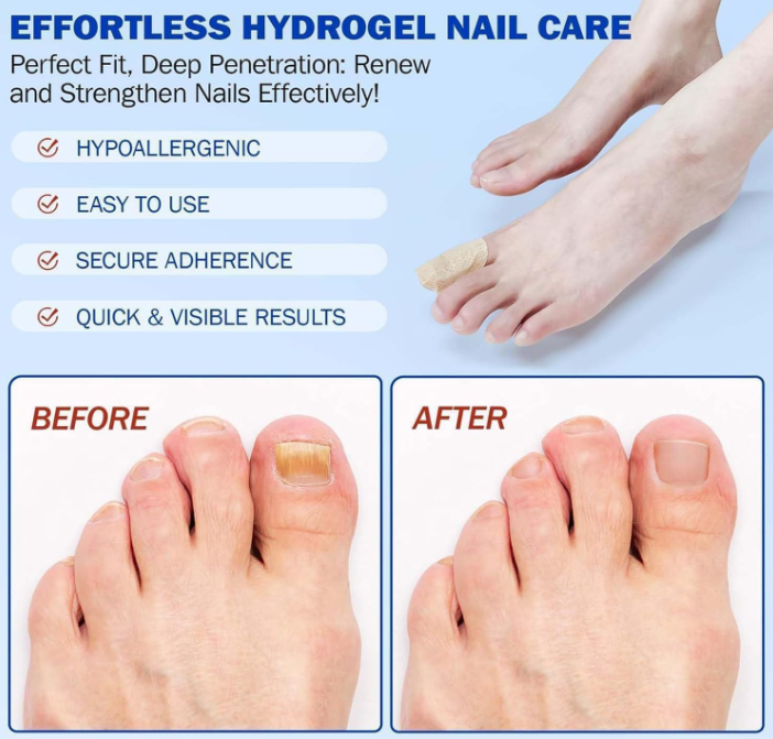 PARCHES PARA HONGOS FUNGAL NAIL X 21